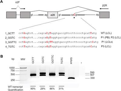 A self-repair history: compensatory effect of a de novo variant on the FANCA c.2778+83C>G splicing mutation